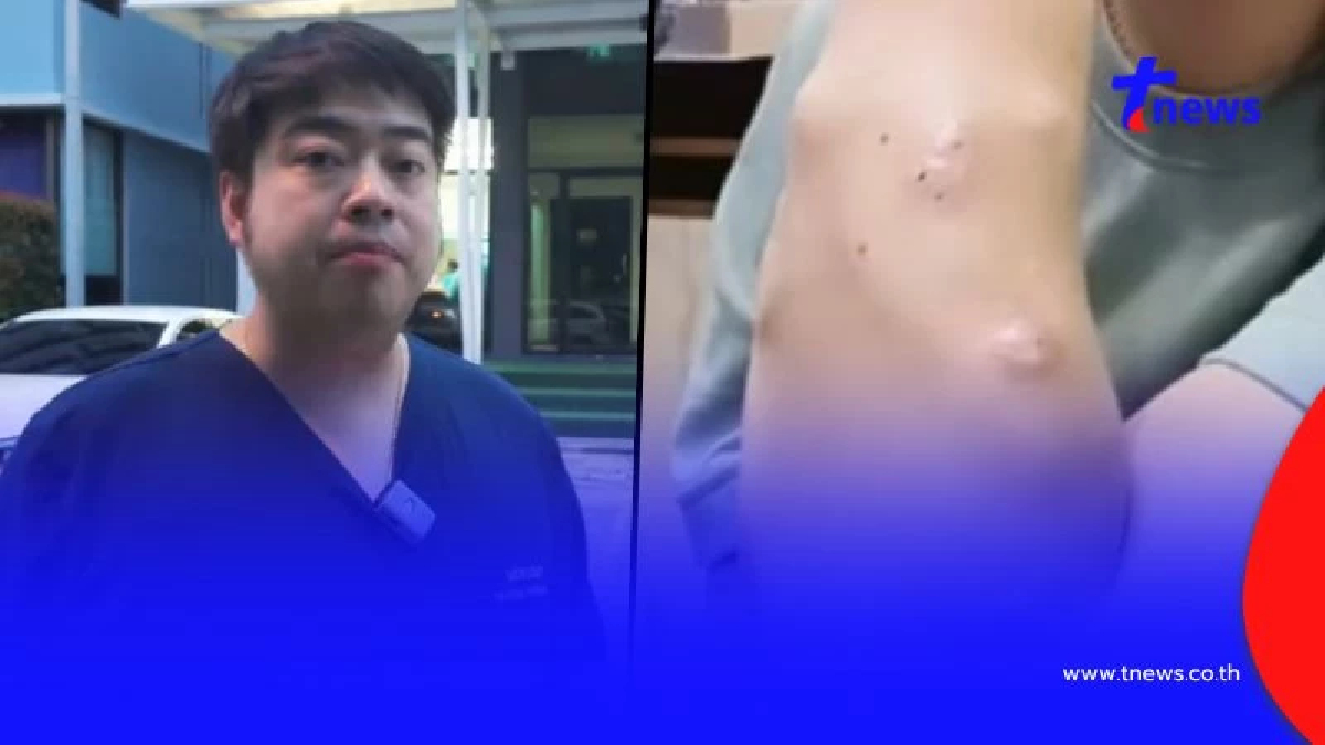 หมอจั๊มเตือน 4 พฤติกรรมเสี่ยง เกิดจากปัสสาวะ ถึงขั้นไตวาย