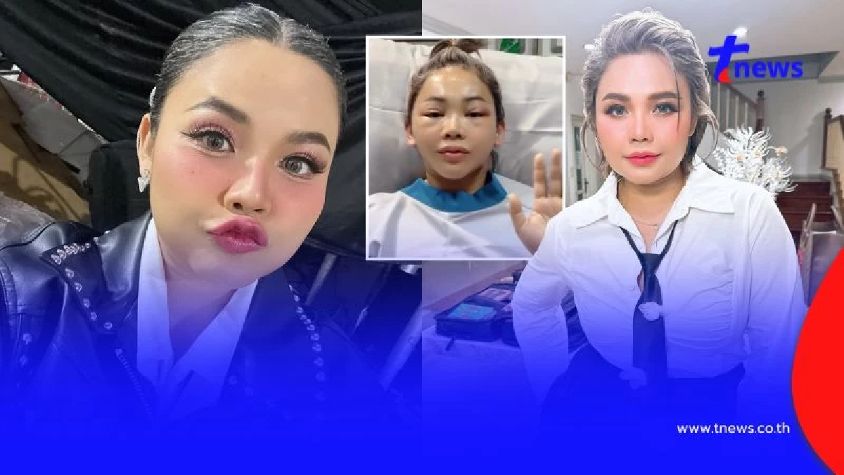 หน้าวีขั้นสุด "ตั๊กแตน ชลดา" ทำศัลยกรรมครั้งใหญ่ หน้าเด็กลงมาก