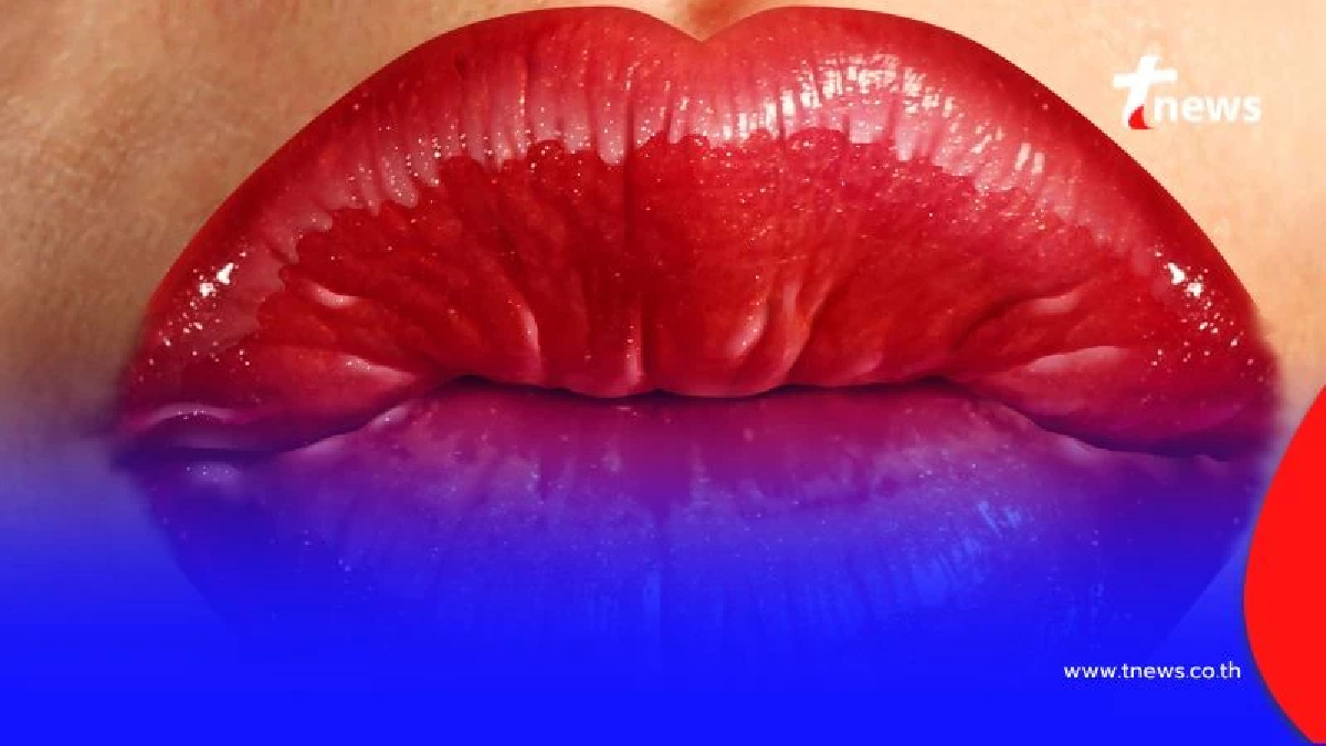 ระวัง การจูบอาจเสี่ยงติด "ซิฟิลิส" ได้หากคุณมีแผลในปาก