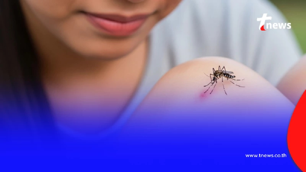 รู้แล้ว ทำไมบางคน ถึงโดน "ยุงกัด" มากกว่าชาวบ้าน อ.เจษฎ์ ตอบชัด