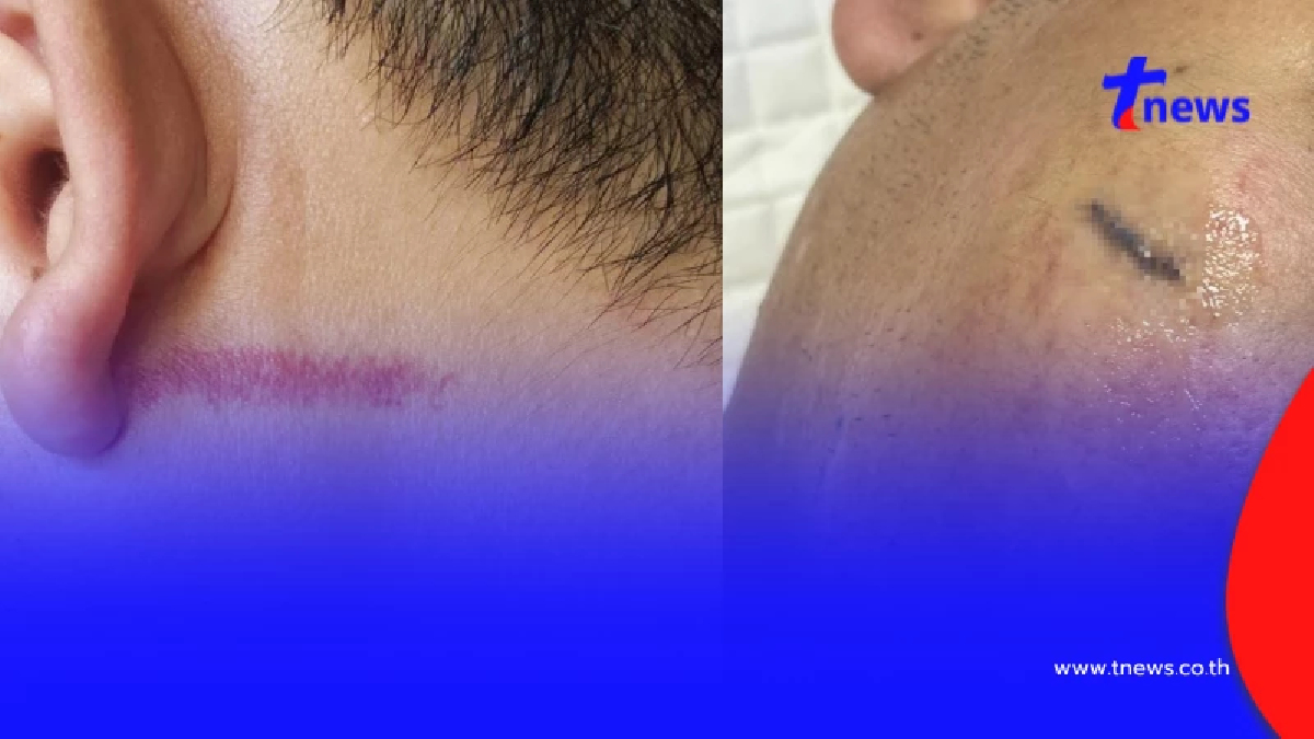 สุดเดือด หนุ่มโดน 20 คน รุมยำกลางร้านดัง รู้สาเหตุยิ่งตกใจ