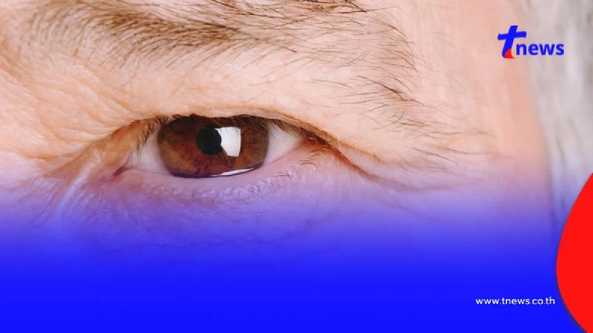 วุ้นในตาเสื่อม อันตรายหรือไม่? สัญญาณเตือนที่ไม่ควรมองข้าม