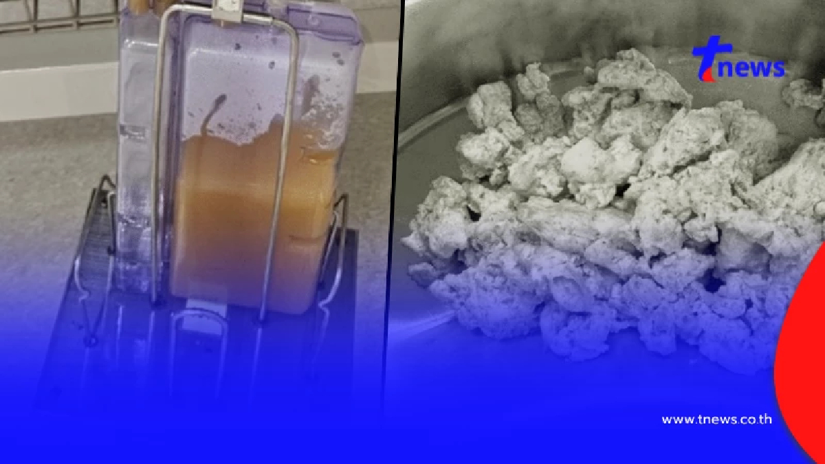 เตือนใครชอบกิน ปูดิบ กุ้งดิบ หลัง สาว 14 เจอหนองในช่องเยื่อหุ้มปอด