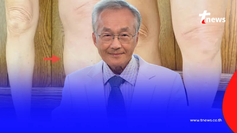 "หมอมนูญ" เปิดเคส ชายขาซ้ายบวมทั้งขา ก่อนเจอต้นตอ สุดอันตราย