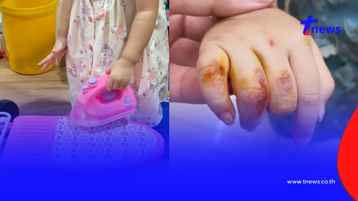 คดีพลิก ลูกเจ็บหนัก โทษของเล่นอันตราย งานนี้คอมเมนต์เดือด