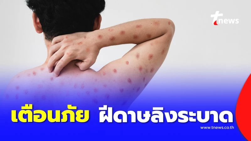 Thailand Component Disease Warning & Prevention
