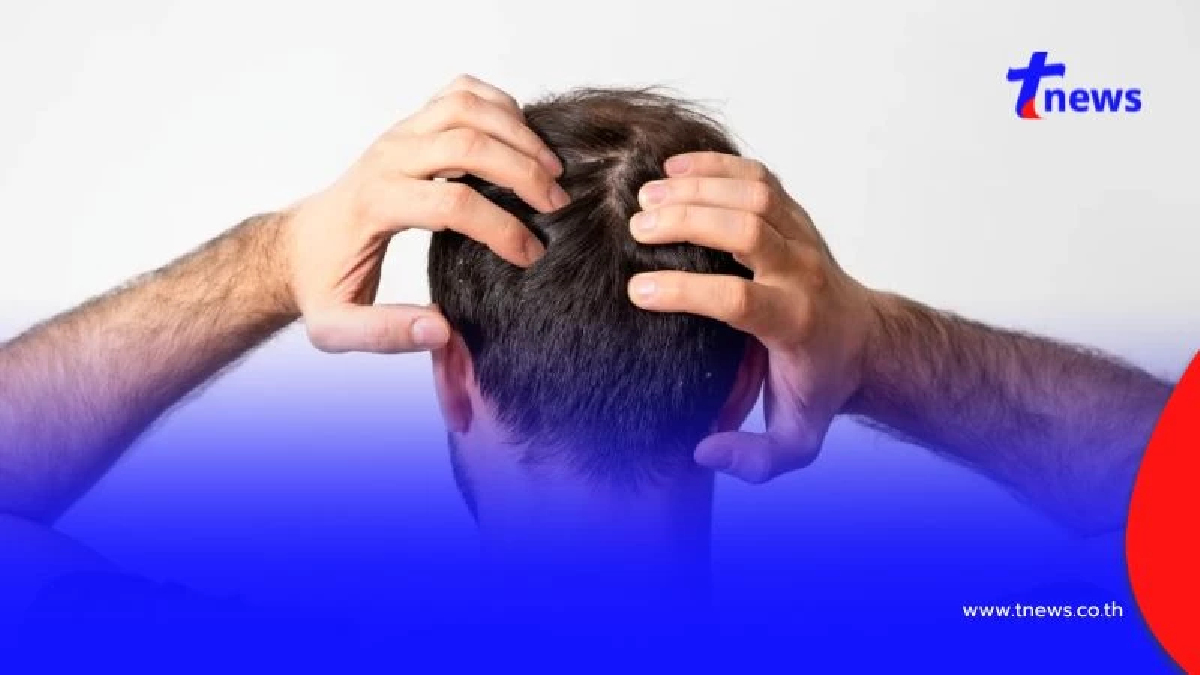 เชื้อราบนหนังศีรษะ อย่ามองข้าม เสี่ยงผมร่วง-คันเรื้อรัง