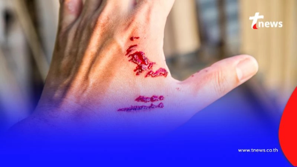 เปิด 6 พฤติกรรม สัตว์เลี้ยงติดโรคพิษสุนัขบ้า พร้อมพื้นที่ฉีดวัคซีนฟรี