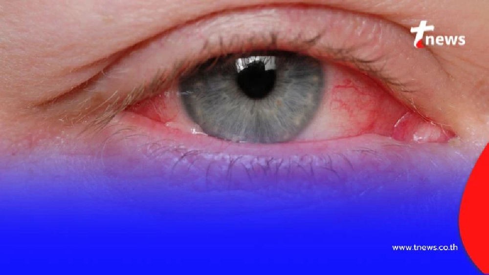 เตือนระวังให้ดี 5 โรคยอดฮิตที่ต้องระวังในช่วงหน้าฝนนี้