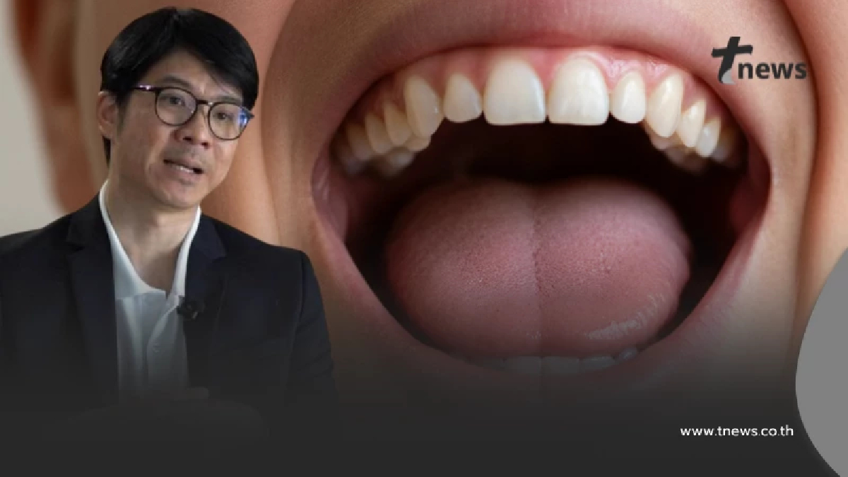 "ปากเหม็น ระวังอัมพาต" อจ.หมอ ชื่อดัง โพสต์เตือนด้วยตัวเอง