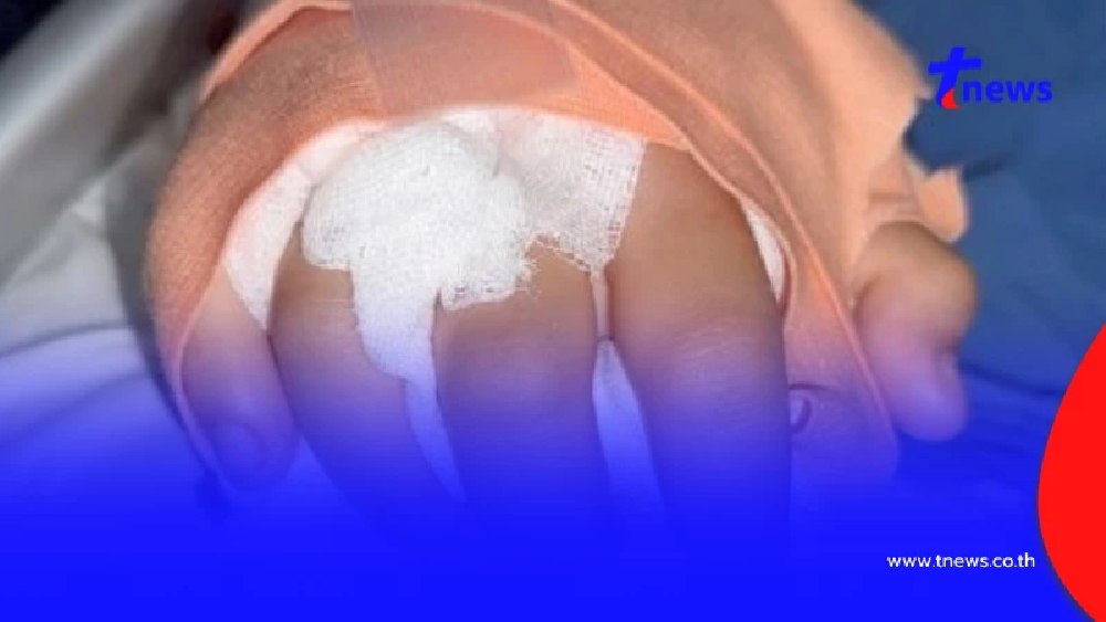 มีข่าวดี อาการล่าสุด "เด็กหญิง14ปี" ถูกแก๊งไทยใหญ่ฟันข้อมือขาด