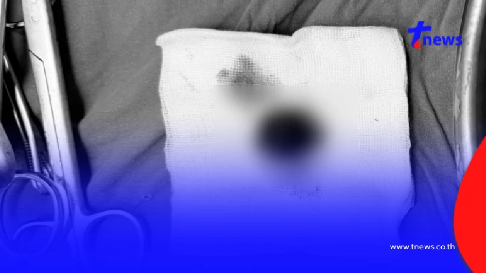 อย่าชะล่าใจ ฝากครรภ์ช้า เสี่ยง "ท้องนอกมดลูก" อันตรายถึงชีวิต