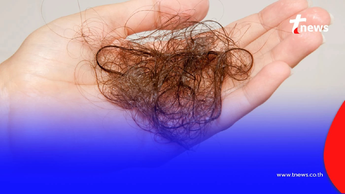เปิดสาเหตุภาวะ ผมร่วงหลังคลอด พร้อม 4 เคล็ดลับกู้ผมหนาคืนมา