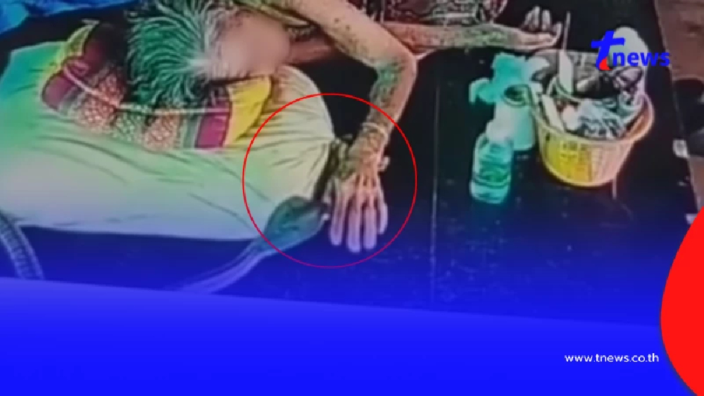 เปิดอาการล่าสุด ยายวัย 93 ปี ถูกงูเห่าฉก ต้องเข้าห้องไอซียู