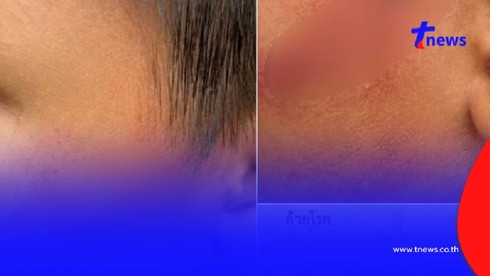 แม่ร่ำไห้ ยอมพูดแล้วสาเหตุลูก 7 ขวบ หยิบขนมครูกิน จนโดนฟุตเหล็กตี