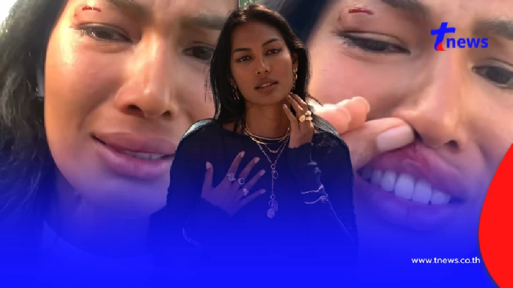 "นางแบบไทย" เผยนาทีระทึก ถูกคนแปลกหน้าทำร้ายกลางลอสแอนเจลิส