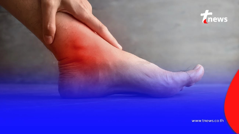 ไขข้อสงสัย ทำไม "กินไก่เยอะ" ถึงเสี่ยงเป็นโรคเกาต์ วันนี้มีคำตอบ