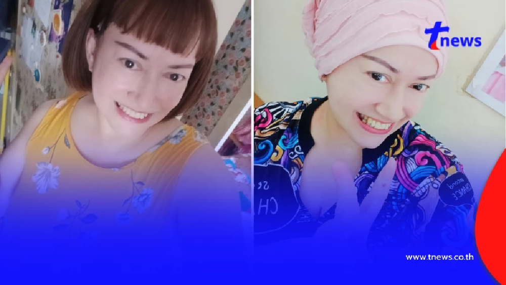 ยิ้มสู้ อดีตนักแสดงดัง โกนผมเตรียมรักษามะเร็งปอด แฟนๆ ส่งกำลังใจ