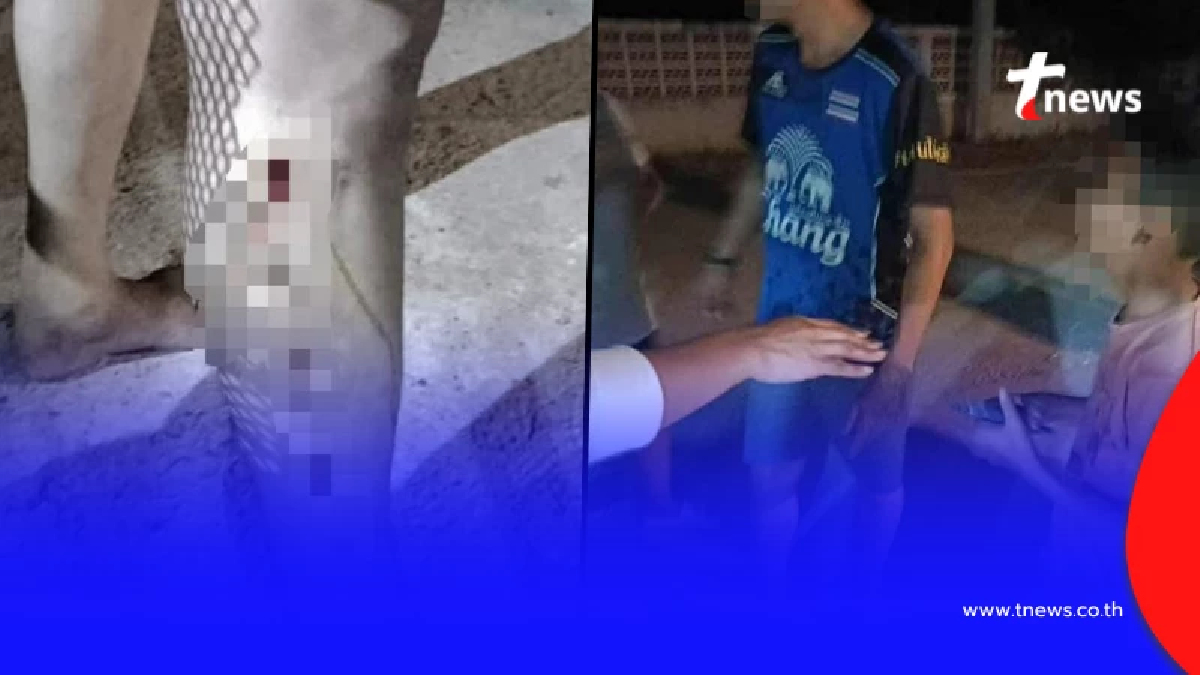 เรื่องใหญ่ "สิงโต" ของคนดัง หลุดจากบ้าน จู่โจมกัด เด็ก ป.5