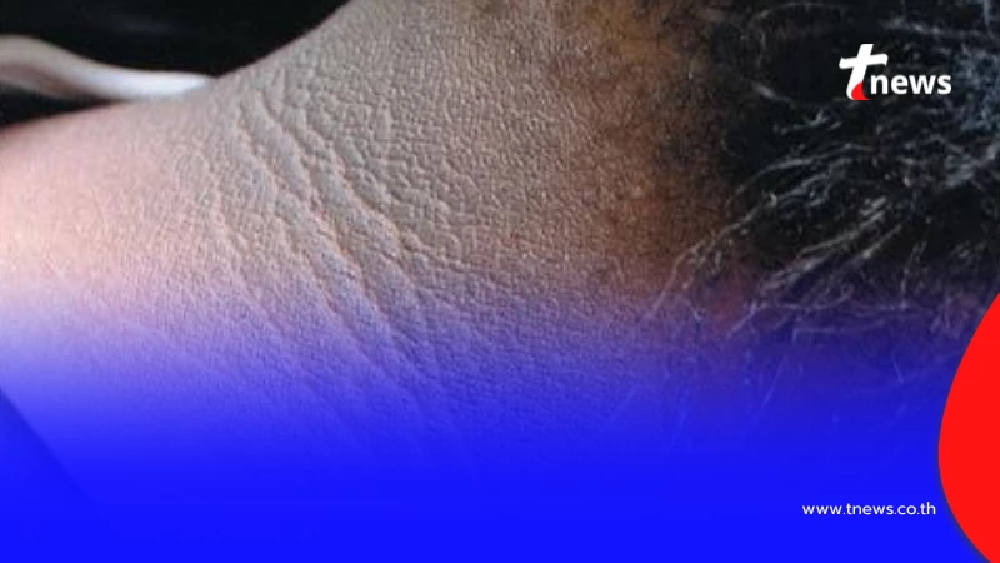 เปิดวิธีแก้ "คอคาร์บอน" ถึงว่า ขัดยังไง ก็ขัดไม่ออกสักที