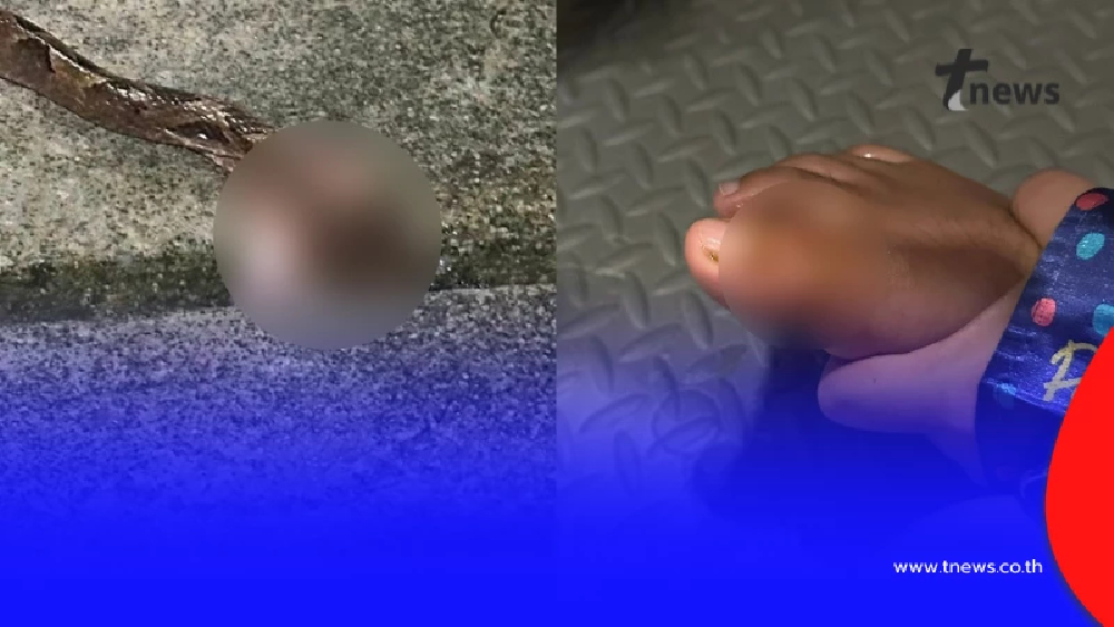 อาการล่าสุด สาวถูกงูกะปะกัดข้ามคืน เหตุน้ำท่วมหาดใหญ่