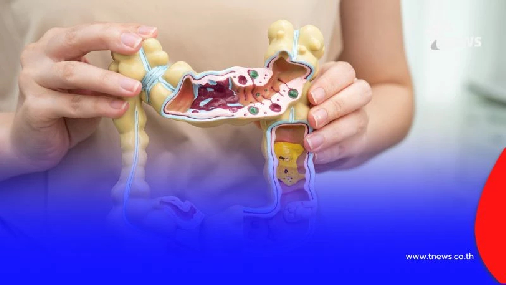 หยุดสงสัย 5 สัญญาณทอง "ลำไส้ดี ไม่อักเสบ ไม่เสียสมดุล" มีคำตอบ