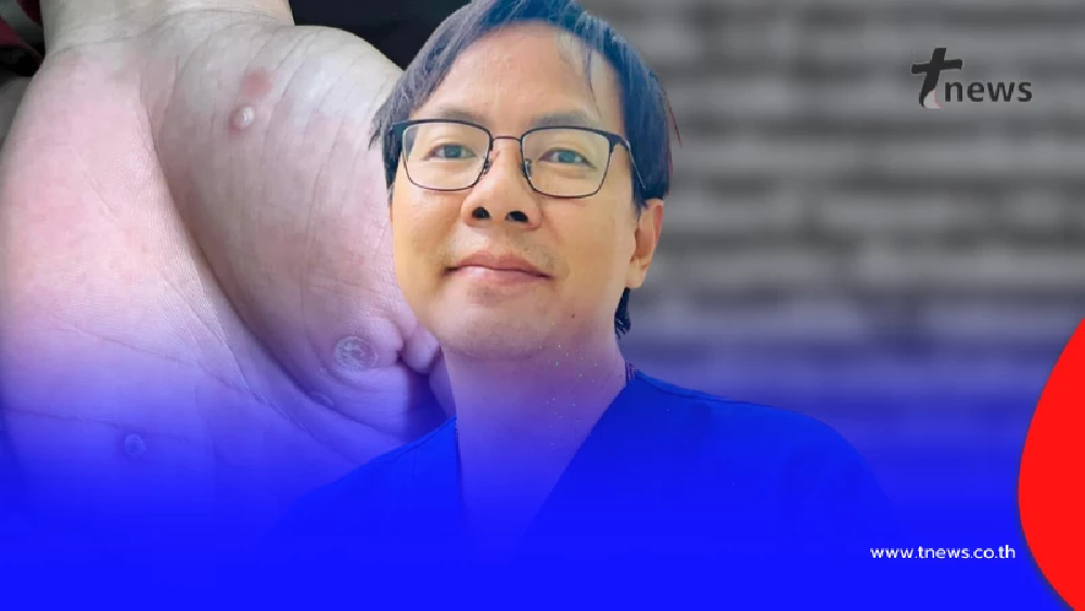 หมอเตือน "ซิฟิลิสระบาดหนัก" แล้ว ใครมีอาการดังนี้ ไปหาหมอด่วน