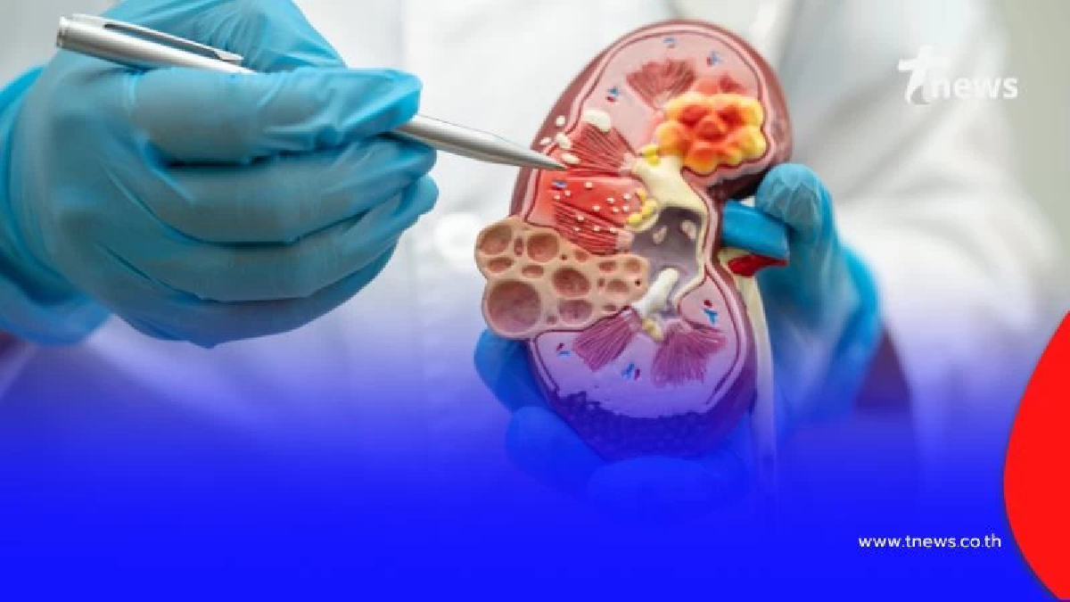 ข่าวดีคนไข้ไต พื้นที่น้ำท่วมไม่ต้องกังวล รัฐจัดให้ไม่มีค่าใช้จ่าย