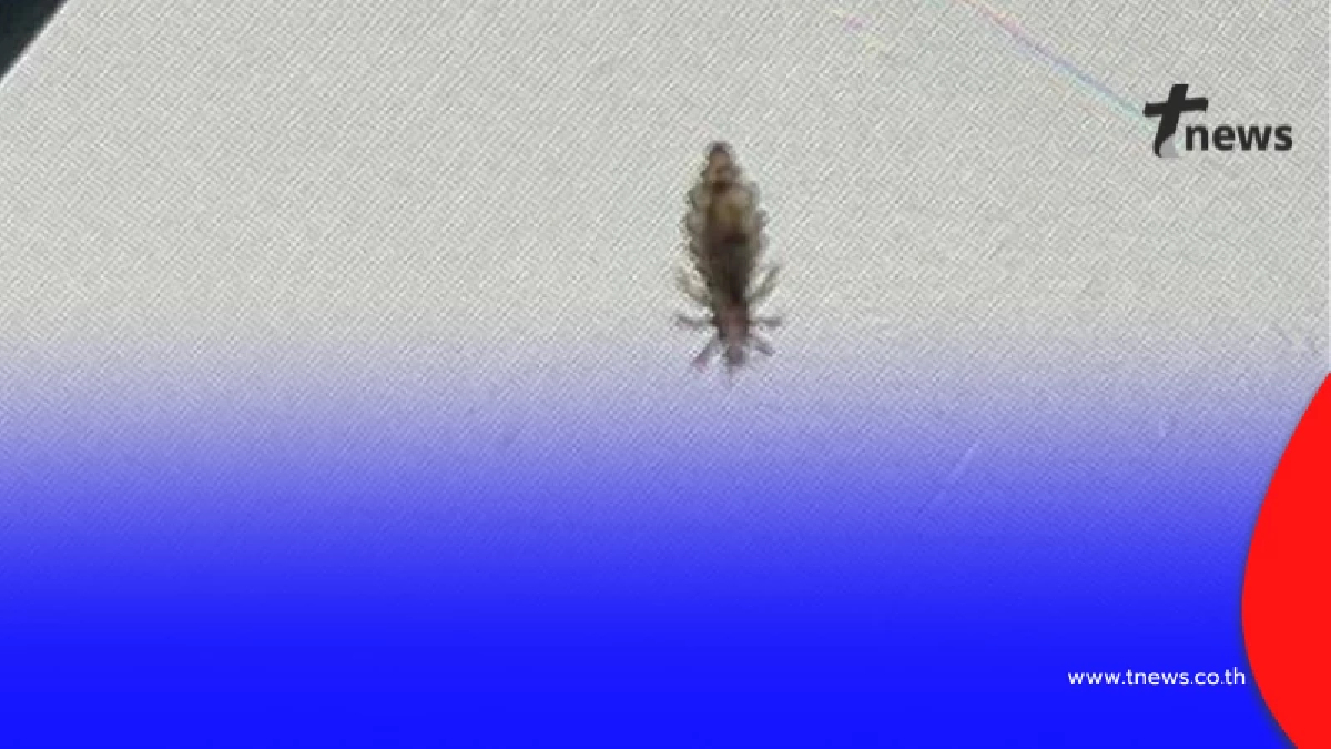 ไวรัลสนั่น สาวผงะ เจอเหา 30 ตัวบนหัว ต้นตอใกล้ตัวกว่าที่คิด