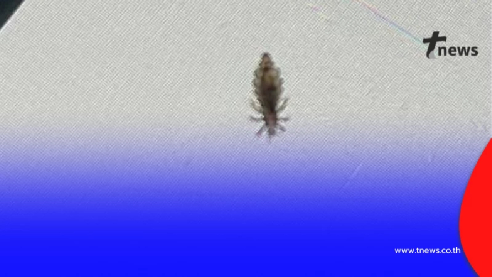 ไวรัลสนั่น สาวผงะ เจอเหา 30 ตัวบนหัว ต้นตอใกล้ตัวกว่าที่คิด