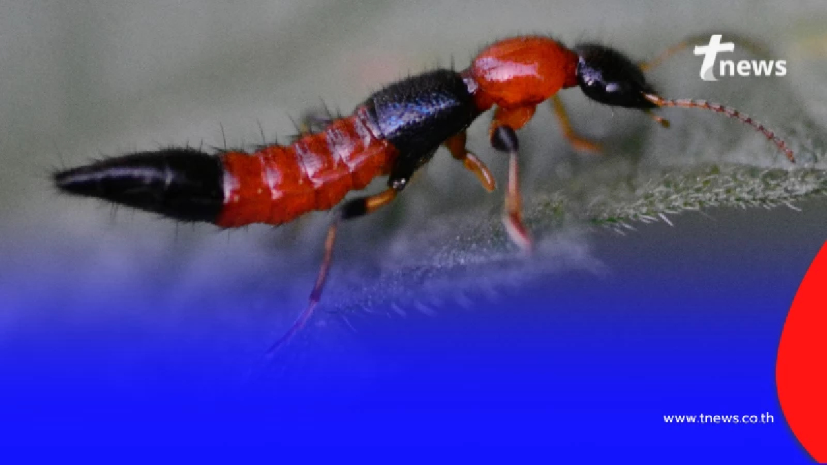 ด้วงก้นกระดก  แมลงร้ายที่ไม่กัด แต่ปล่อยพิษทำผิวหนังอักเสบแดง-แสบพอง
