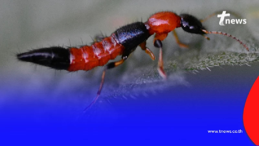 ด้วงก้นกระดก  แมลงร้ายที่ไม่กัด แต่ปล่อยพิษทำผิวหนังอักเสบแดง-แสบพอง