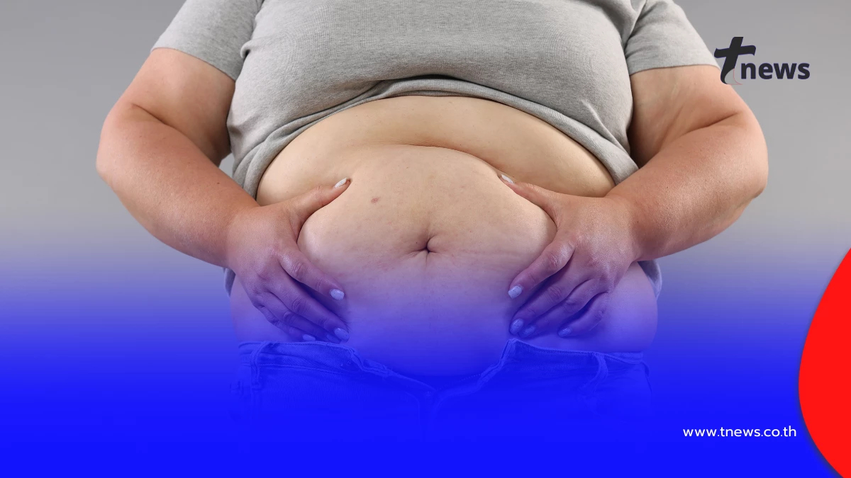 รู้จัก “อ้วนเพราะฮอร์โมน” ตัวการเงียบที่หลายคนมองข้าม