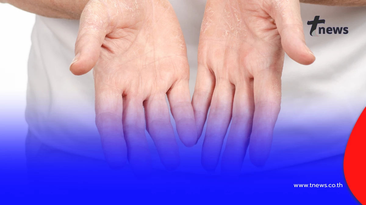 มีหรือไม่ “ฝ่ามือตะปบทรัพย์” ลายมือคนดวงการเงินแรง วาสนาดี