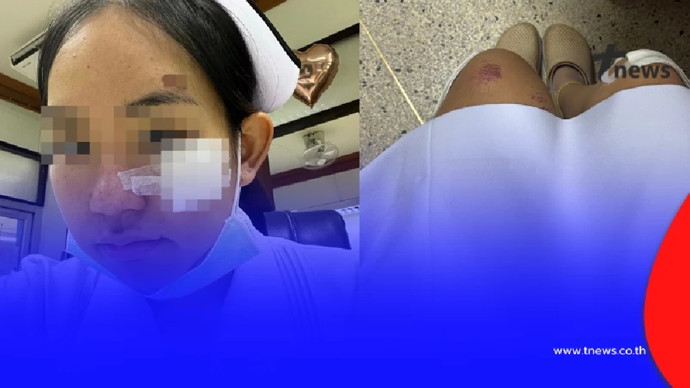 ชีวิตจริงพยาบาลสาว รถล้มเจ็บก็ต้องมาทำงาน เหตุผลตัดสินใจลาออก