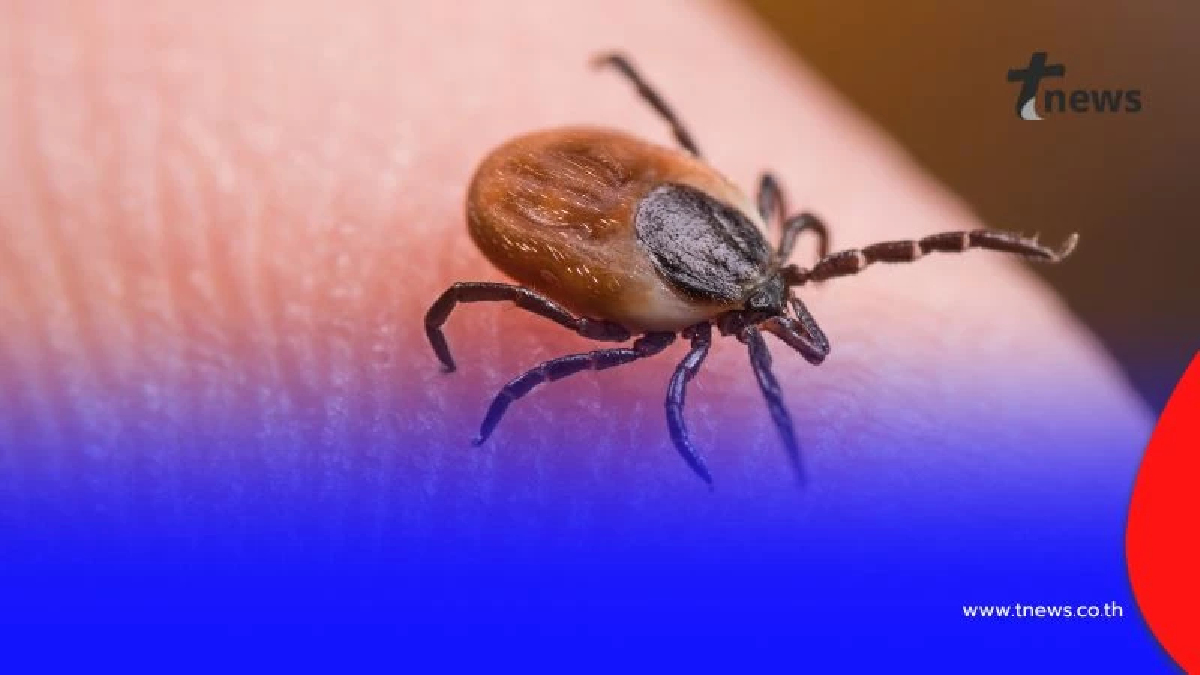 อันตรายจาก “โรคเห็บ” ภัยเงียบที่ผู้ป่วยไม่ควรมองข้าม อาจรุนแรงถึงชีวิต