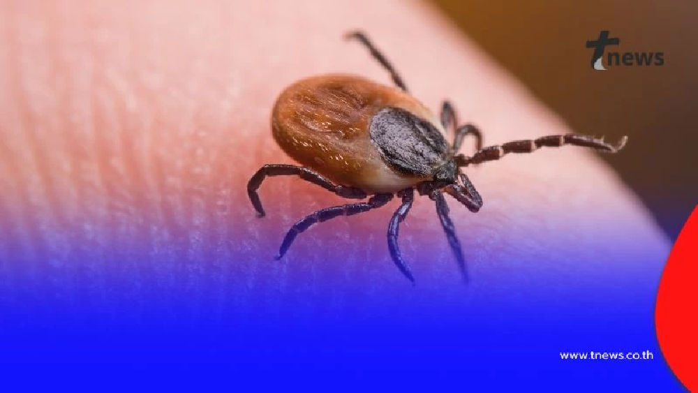 อันตรายจาก “โรคเห็บ” ภัยเงียบที่ผู้ป่วยไม่ควรมองข้าม อาจรุนแรงถึงชีวิต
