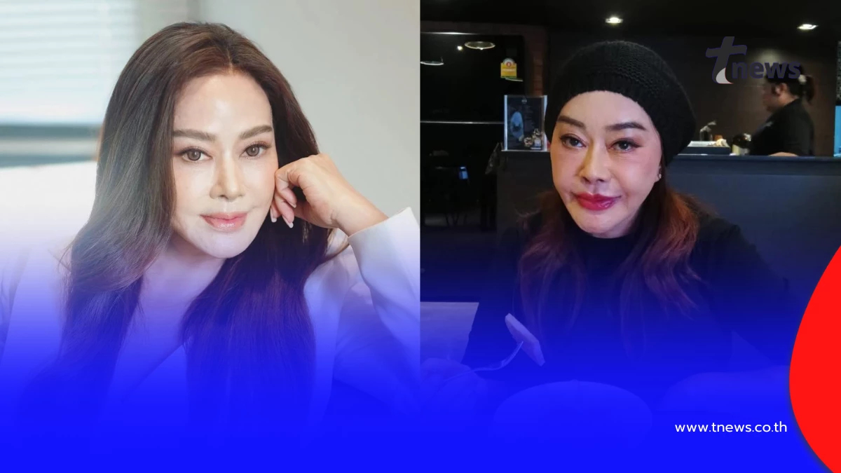 “จิ๊ก เนาวรัตน์” เผยโฉมหน้าใหม่  หลังทนพิษศัลยกรรมนาน 3 ปี