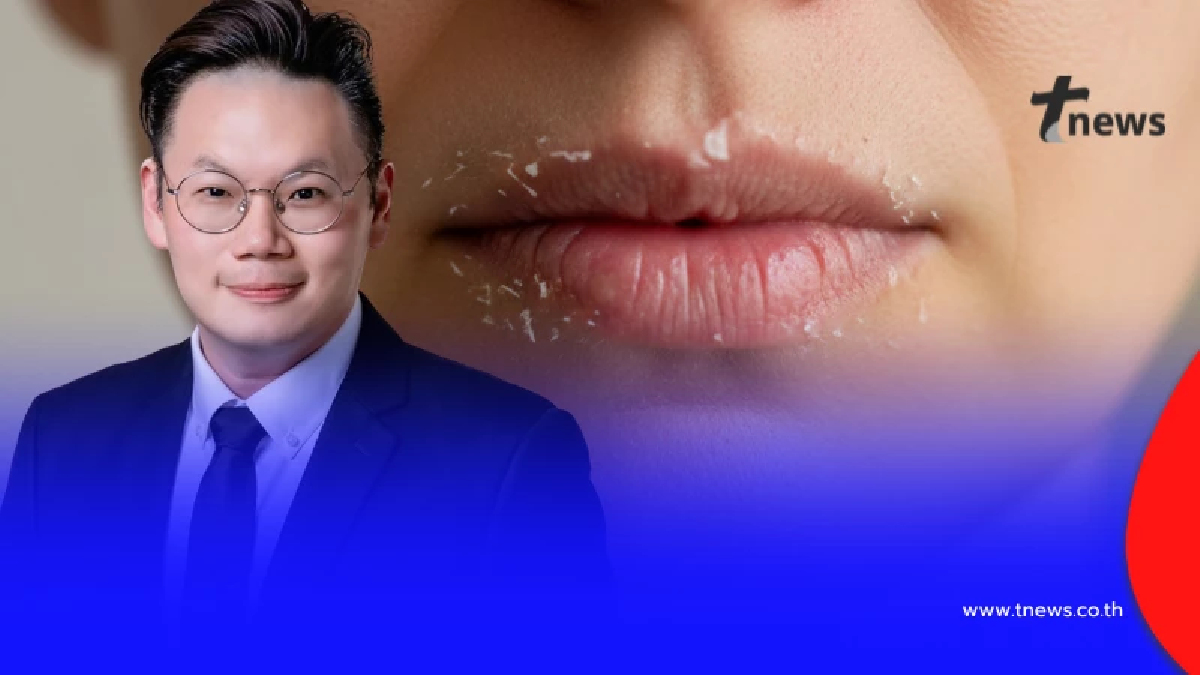 ใคร "ปากแห้ง - ลิ้นขาว" สังเกตตัวเองด่วน หมอเจด เตือนแล้ว ล่าสุด