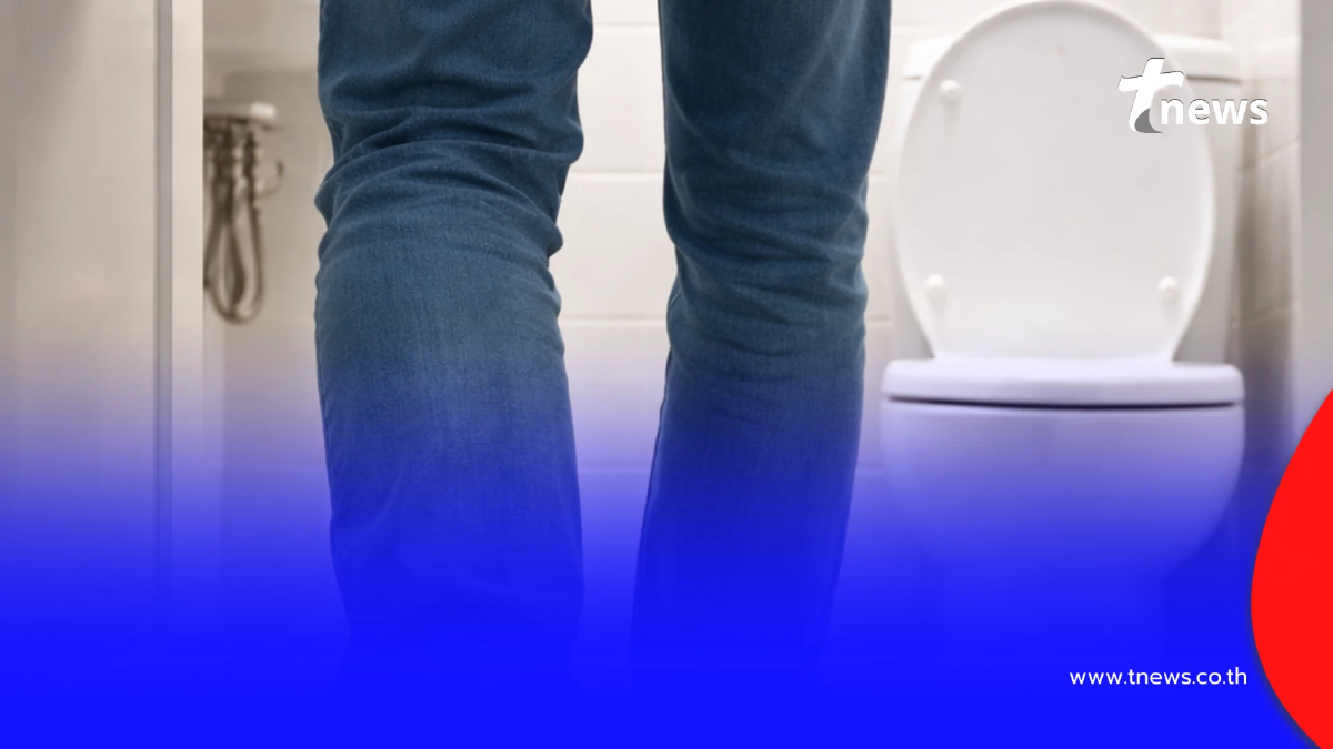 ไม่ใช่เรื่องเล็ก หมอเตือน 5 อาการ ขับถ่ายผิดปกติ เสี่ยงมะเร็งลำไส้