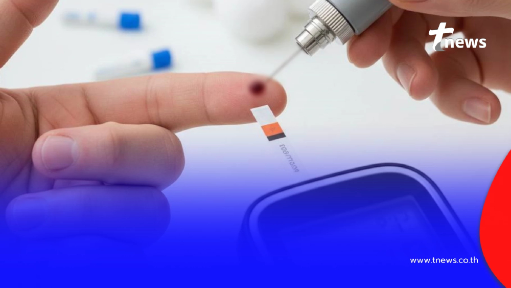 หมอเปิด 5 อาการเตือน สัญญาณน้ำตาลพุ่ง ไม่ต้องเจาะเลือดก็เช็กได้