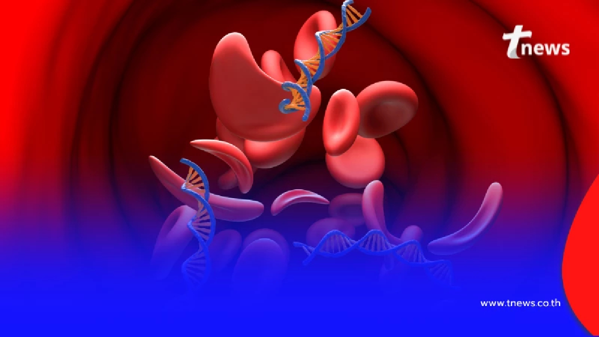 เปิด 5 ลิสต์ต้องห้าม ถ้าอยากรักษาไตให้อยู่กับเราไปนานๆ