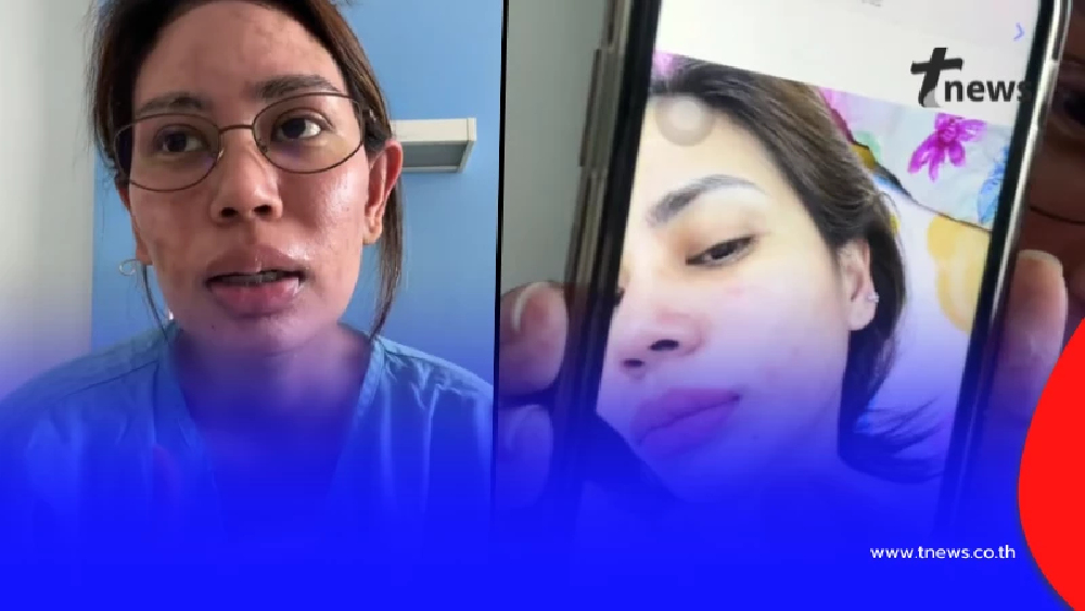 สาวเล่าอุทาหรณ์ แค่ผื่นเล็ก ๆ สุดท้ายเกือบเอาชีวิตไม่รอด