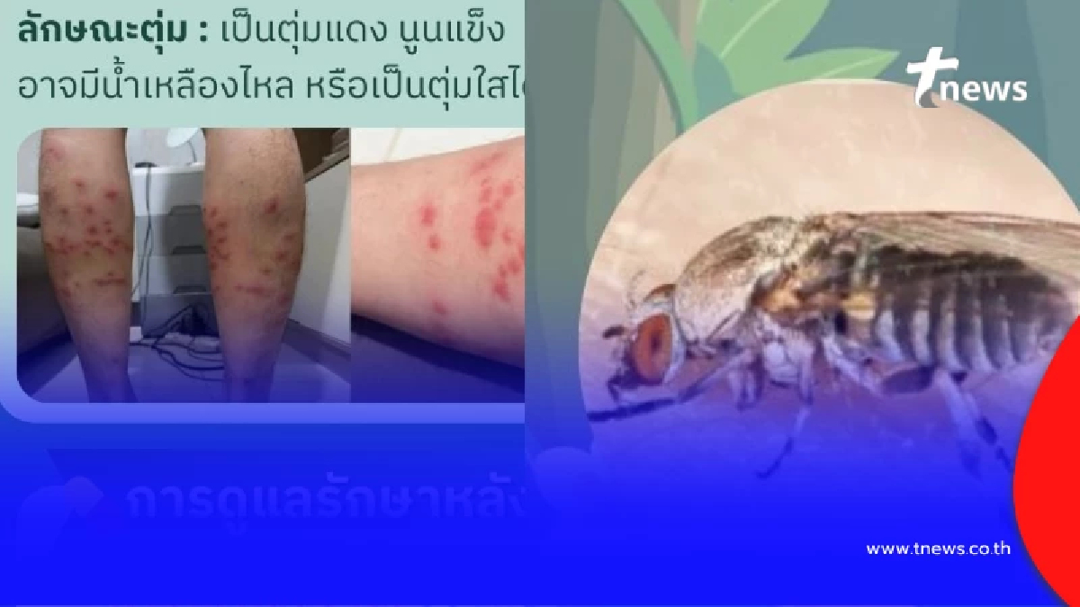 ออกแล้วสาเหตุเสียชีวิต ชายวัย 68 โดนตัวคุ่นกัด ผลชันสูตรน่าตกใจ