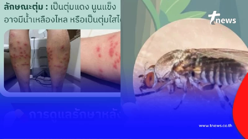 ออกแล้วสาเหตุเสียชีวิต ชายวัย 68 โดนตัวคุ่นกัด ผลชันสูตรน่าตกใจ