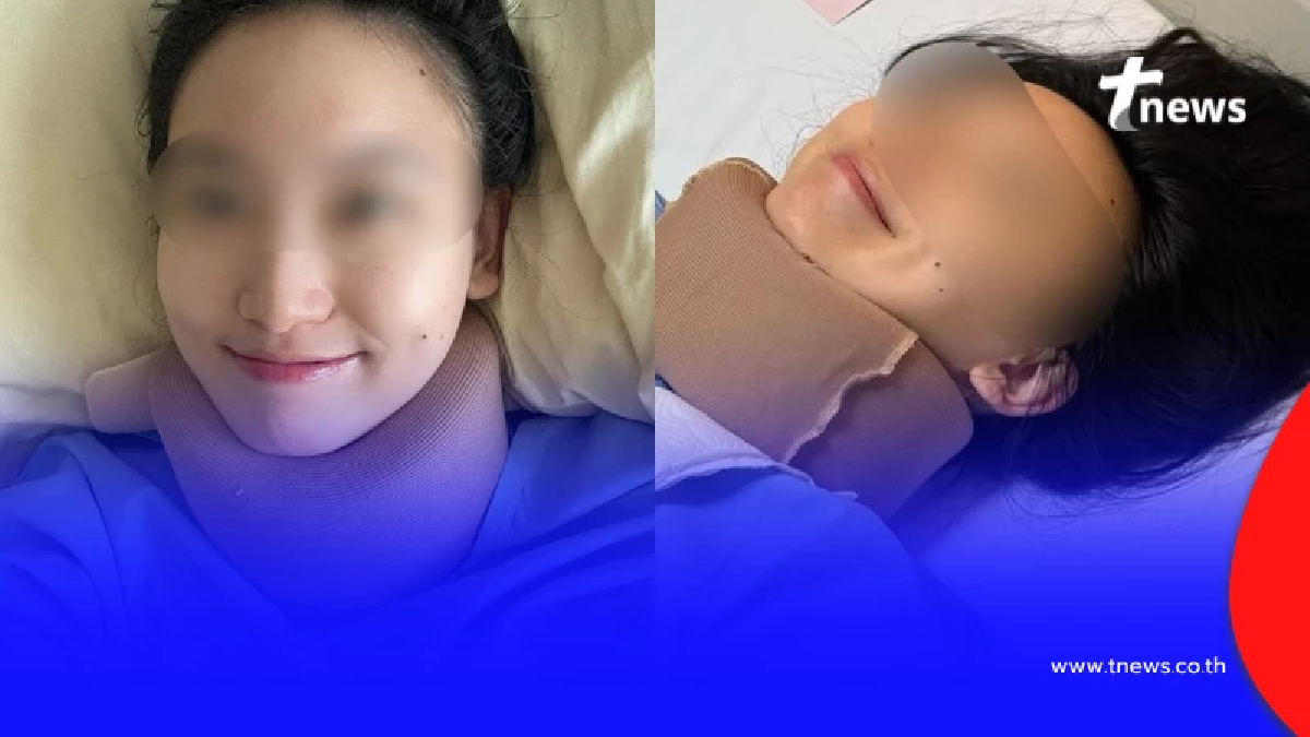 หมอสาวเจ็บหนัก ไรเดอร์พาฝ่าไฟแดงชนสนั่น ฟื้นมารีบเช็กเส้นประสาท