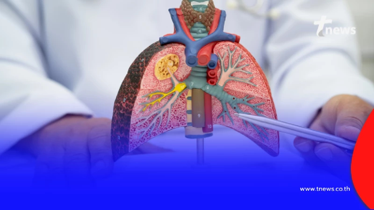 ส่องสถานการณ์โรคปอดอักเสบเด็กไทยปี 2568 สถิติพุ่งสูง พ่อแม่ต้องเฝ้าระวังใกล้ชิด