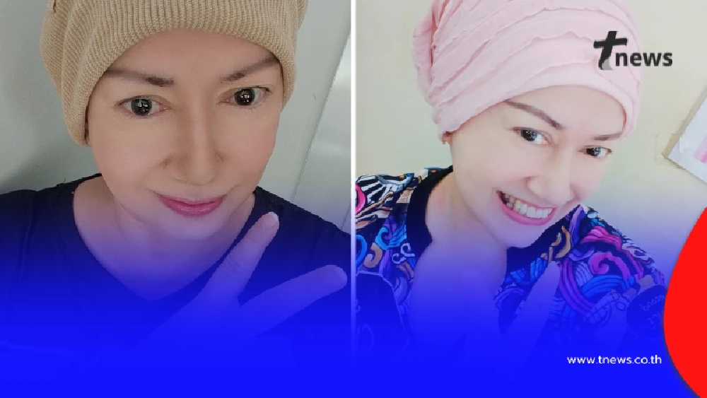 ยิ้มสู้ "อดีตนักแสดงดัง" หมอเพิ่มคีโม ต้องโกนผมอีกรอบ