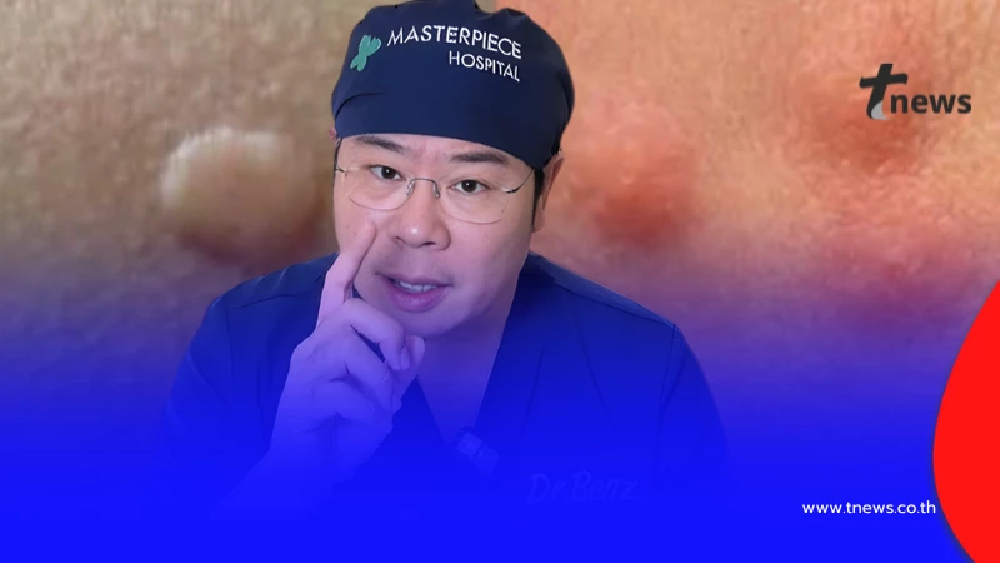 หมอดัง เผยชัด "ยุง vs คุ่น" ต่างกันตรงไหน เสี่ยงติดเชื้อได้ยังไง