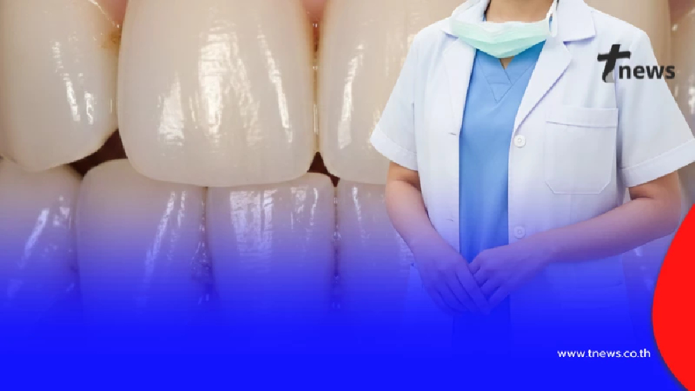 หมอตอบแล้ว "ควรขูดหินปูนบ่อยแค่ไหน" ถึงดีที่สุด หลายคนไม่เคยรู้